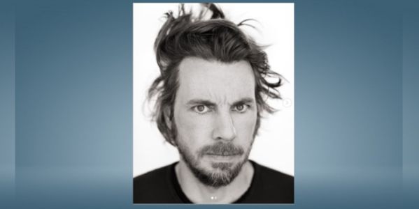 Actor Dax Shepard requires surgery after getting busted up in motorcycle accident
