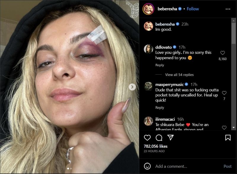 Ace News Today - Singer Bebe Rexha assaulted on stage during performance in New York City