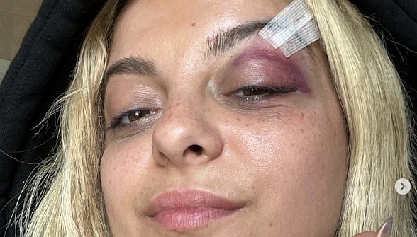 Singer Bebe Rexha assaulted on stage last night in during performance in NYC