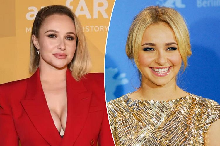 Ace News Today: Beloved actress Hayden Panettiere dies at 36. Image credit: X